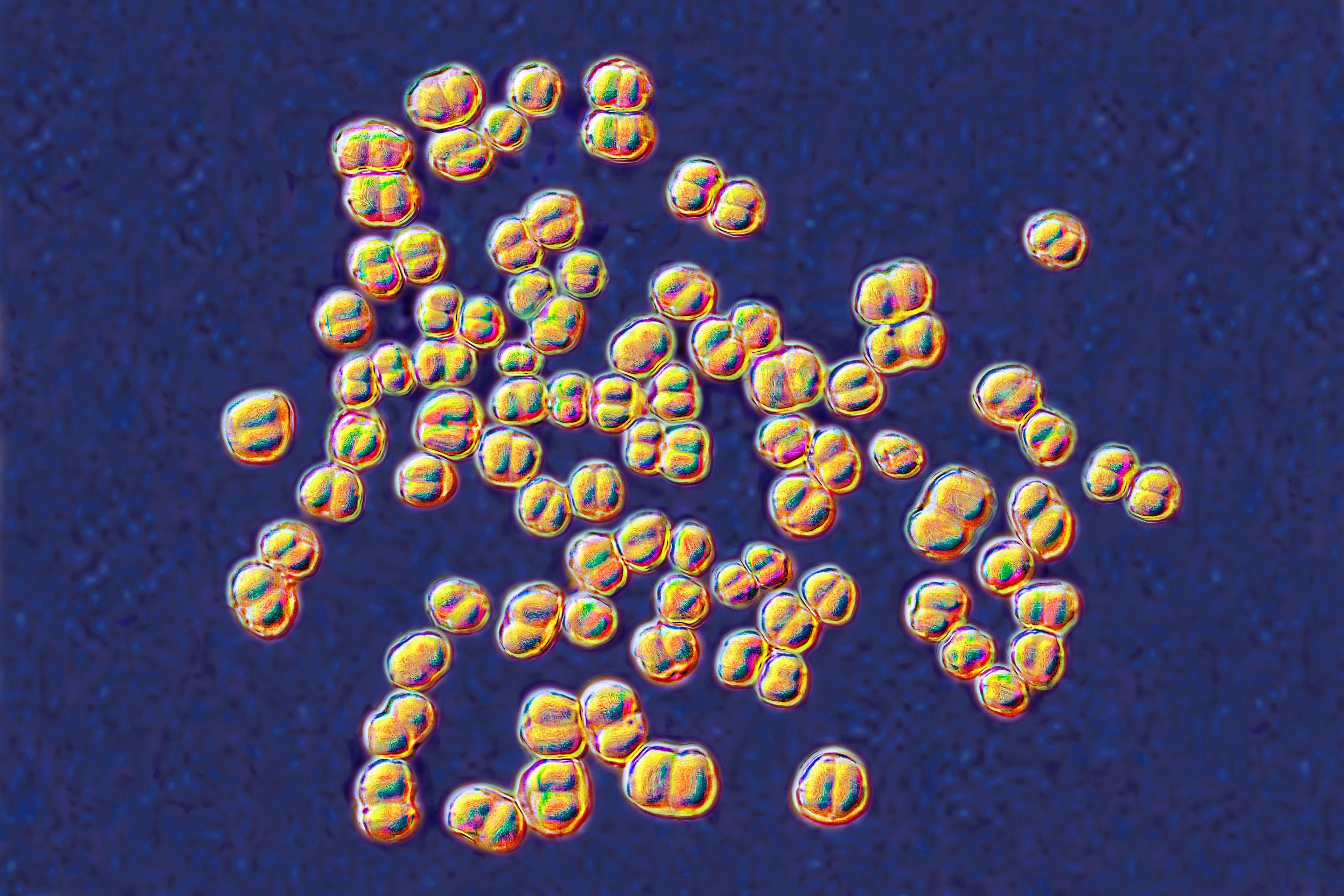 College lab class ends with 32 people on antibiotics for deadly germ exposure