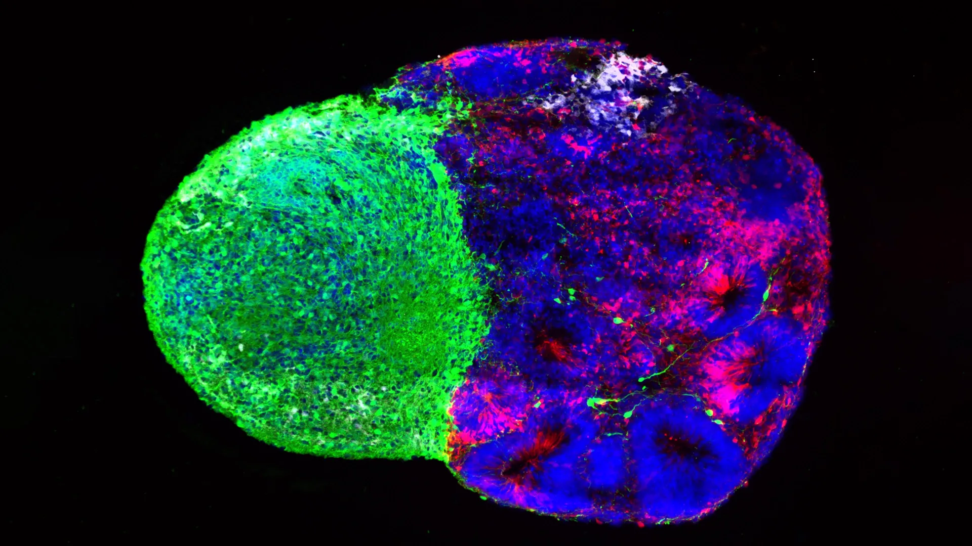 Scientists reveal the hidden instructions that build the human brain