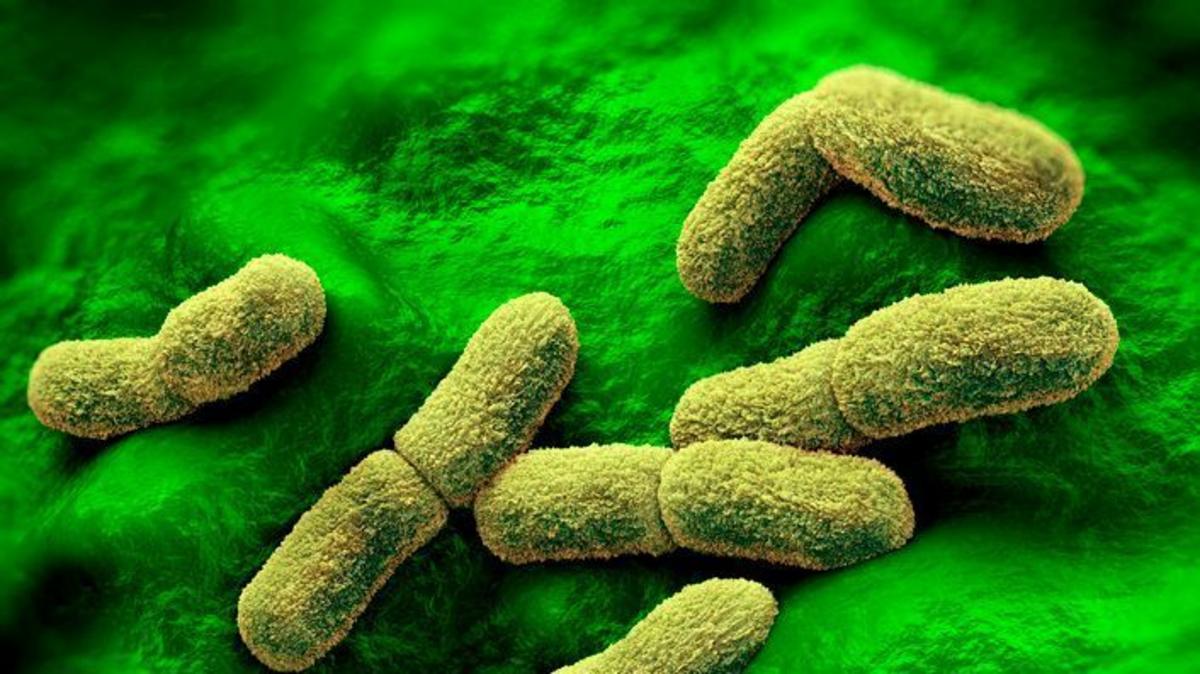 US 'watching closely' after plague researcher dies in Russia