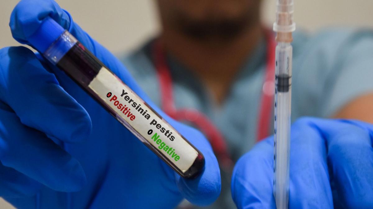 Qué es y cómo se propaga la peste neumónica que se estudia en el laboratorio de Siberia en el que falleció una trabajadora