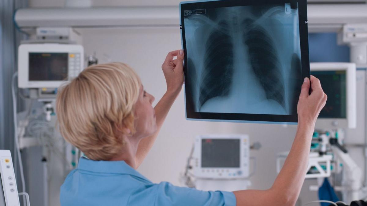 Qué es un adenocarcinoma pulmonar, el tipo de tumor maligno que le extirparon al papa León XIV